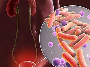 Μείγμα ουρολοίμωξης 120γρ